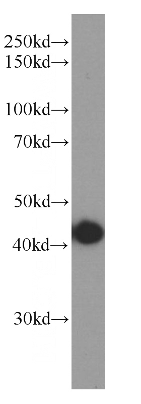U-251 cells were subjected to SDS PAGE followed by western blot with Catalog No:107627(TMEM106B Antibody) at dilution of 1:1000