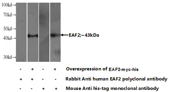 Transfected HEK-293 cells were subjected to SDS PAGE followed by western blot with Catalog No:110162(EAF2 Antibody) at dilution of 1:500