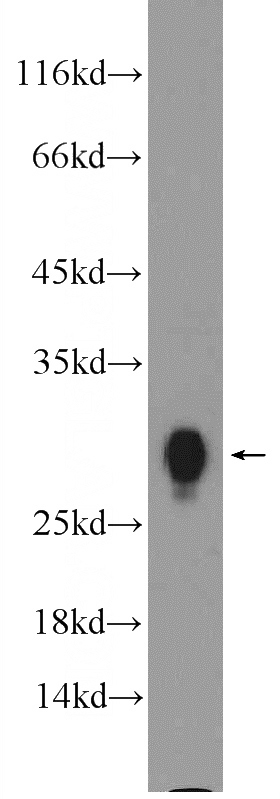 human spleen tissue were subjected to SDS PAGE followed by western blot with Catalog No:111426(HLA-DRB1 Antibody) at dilution of 1:1000