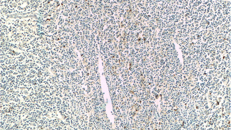 Immunohistochemistry of paraffin-embedded human tonsillitis tissue slide using Catalog No:112223(LILRA2 Antibody) at dilution of 1:200 (under 10x lens)