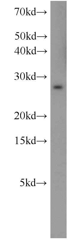COLO 320 cells were subjected to SDS PAGE followed by western blot with Catalog No:115424(Loc57228 antibody) at dilution of 1:600