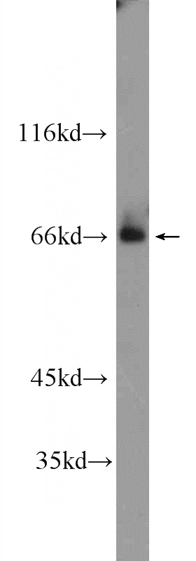 HeLa cells were subjected to SDS PAGE followed by western blot with Catalog No:117064(ZKSCAN1 Antibody) at dilution of 1:600
