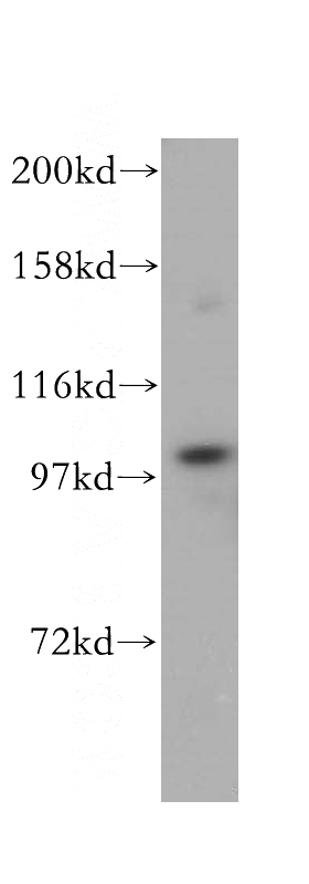 mouse thymus tissue were subjected to SDS PAGE followed by western blot with Catalog No:108786(C7 antibody) at dilution of 1:500