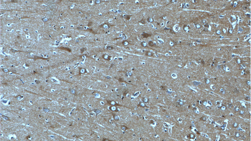 Immunohistochemistry of paraffin-embedded human brain tissue slide using Catalog No:108915(CAMK2A-Specific Antibody) at dilution of 1:50 (under 10x lens)