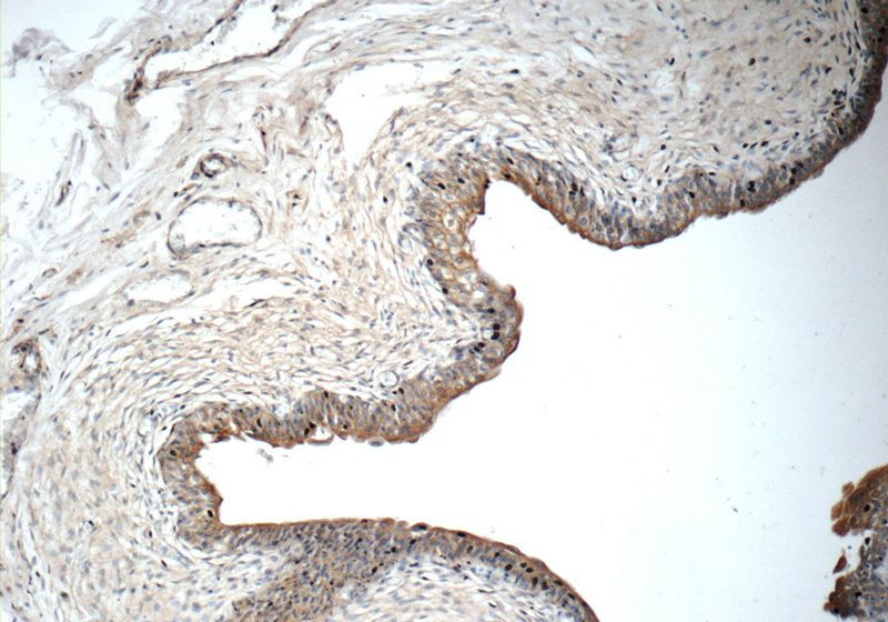 Immunohistochemistry of paraffin-embedded human bladder tissue slide using Catalog No:115072(SDR42E1 Antibody) at dilution of 1:50 (under 10x lens)