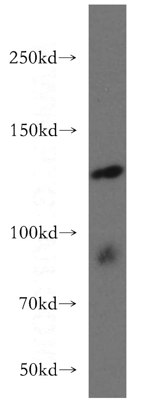 mouse testis tissue were subjected to SDS PAGE followed by western blot with Catalog No:108185(ARHGEF18 antibody) at dilution of 1:300