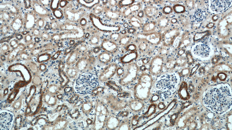 Immunohistochemical of paraffin-embedded human kidney using Catalog No:115372(SLC37A4 antibody) at dilution of 1:50 (under 10x lens)