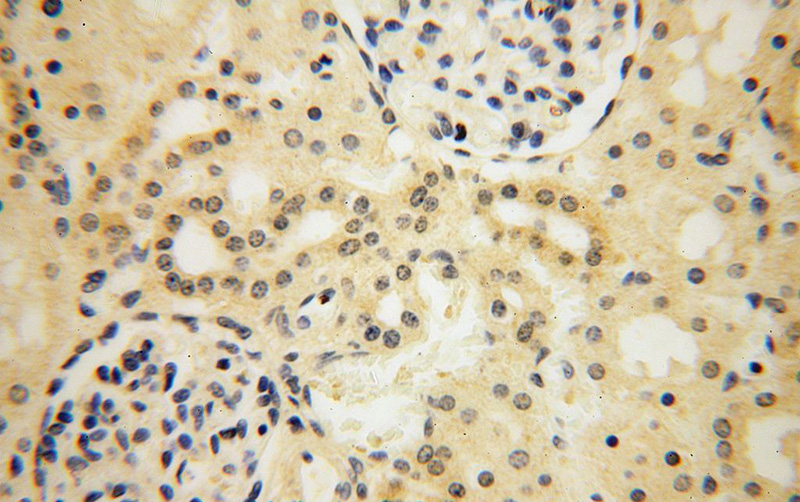 Immunohistochemical of paraffin-embedded human kidney using Catalog No:115868(TBC1D5 antibody) at dilution of 1:100 (under 40x lens)