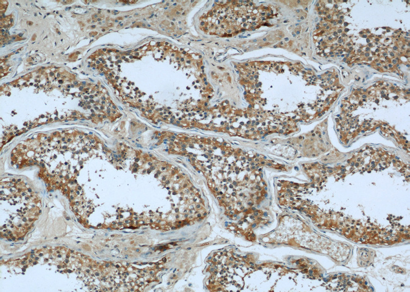 Immunohistochemical of paraffin-embedded human testis using Catalog No:107168(CFL1 antibody) at dilution of 1:50 (under 10x lens)