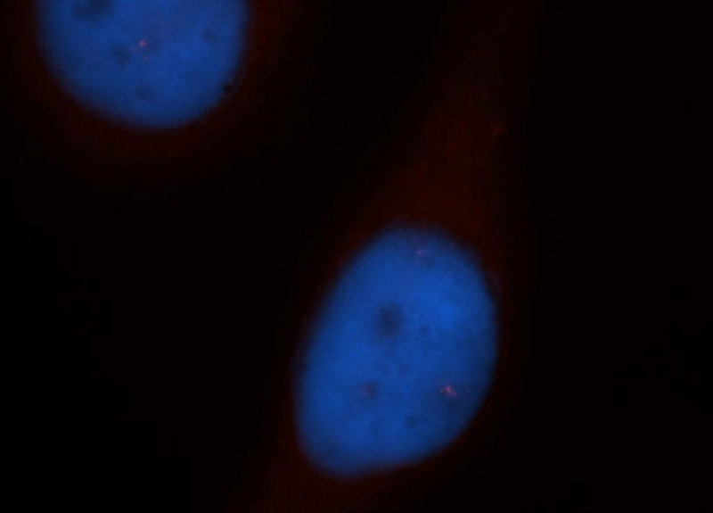 Immunofluorescent analysis of Hela cells, using PSMB1 antibody Catalog No:114379 at 1:25 dilution and Rhodamine-labeled goat anti-rabbit IgG (red). Blue pseudocolor = DAPI (fluorescent DNA dye).