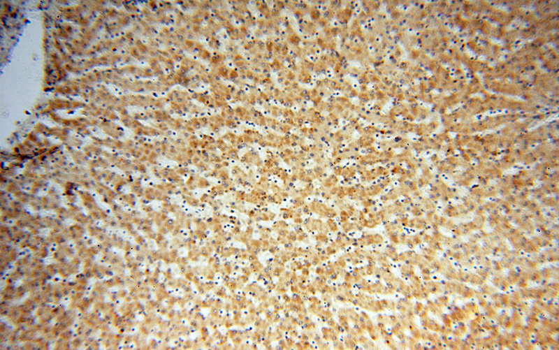 Immunohistochemical of paraffin-embedded human liver using Catalog No:112356(LSS antibody) at dilution of 1:50 (under 10x lens)