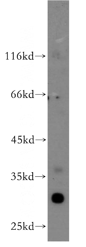A375 cells were subjected to SDS PAGE followed by western blot with Catalog No:112960(NAT1 antibody) at dilution of 1:300