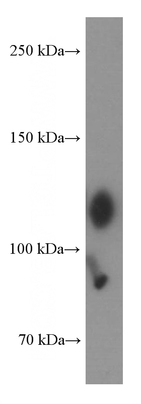 human colon tissue were subjected to SDS PAGE followed by western blot with Catalog No:107146(CDH17 Antibody) at dilution of 1:1000