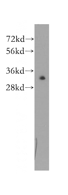 HeLa cells were subjected to SDS PAGE followed by western blot with Catalog No:114509(RAD1 antibody) at dilution of 1:300