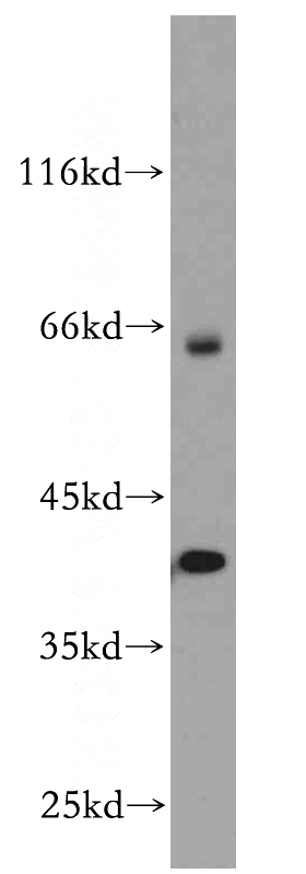 mouse brain tissue were subjected to SDS PAGE followed by western blot with Catalog No:112079(SP6 antibody) at dilution of 1:500