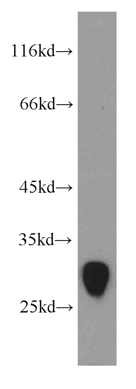 mouse small intestine tissue were subjected to SDS PAGE followed by western blot with Catalog No:116188(TMEM41A antibody) at dilution of 1:800