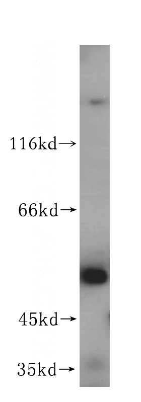 human heart tissue were subjected to SDS PAGE followed by western blot with Catalog No:110791(FUCA2 antibody) at dilution of 1:500