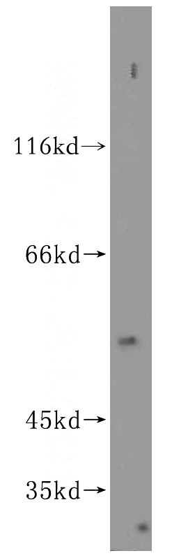 HepG2 cells were subjected to SDS PAGE followed by western blot with Catalog No:115557(SPATS2L antibody) at dilution of 1:600