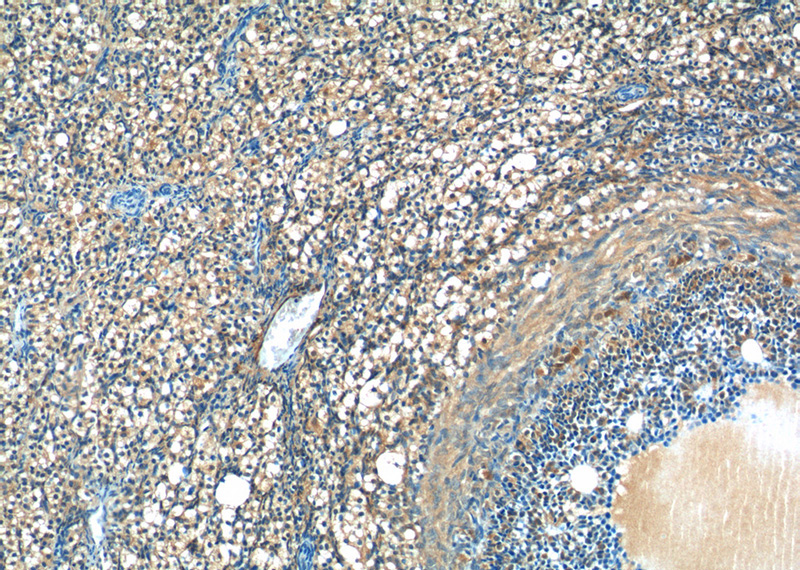 Immunohistochemistry of paraffin-embedded human ovary tissue slide using Catalog No:116674(UCHL5IP Antibody) at dilution of 1:50 (under 10x lens)