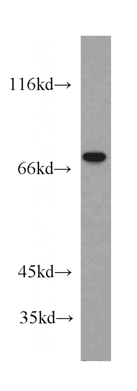 L02 cells were subjected to SDS PAGE followed by western blot with Catalog No:116244(TOP1 antibody) at dilution of 1:300