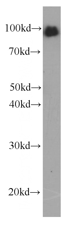 human blood tissue were subjected to SDS PAGE followed by western blot with Catalog No:107376(LGALS3BP Antibody) at dilution of 1:2000