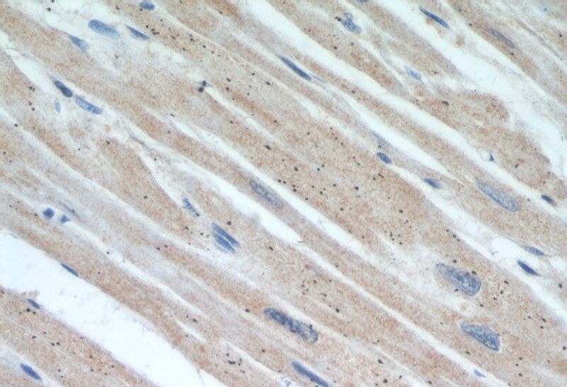 Immunohistochemical of paraffin-embedded human heart using Catalog No:114664(RHOT2 antibody) at dilution of 1:50 (under 40x lens)