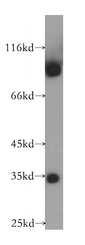 human skeletal muscle tissue were subjected to SDS PAGE followed by western blot with Catalog No:112180(LDB3 antibody) at dilution of 1:1000