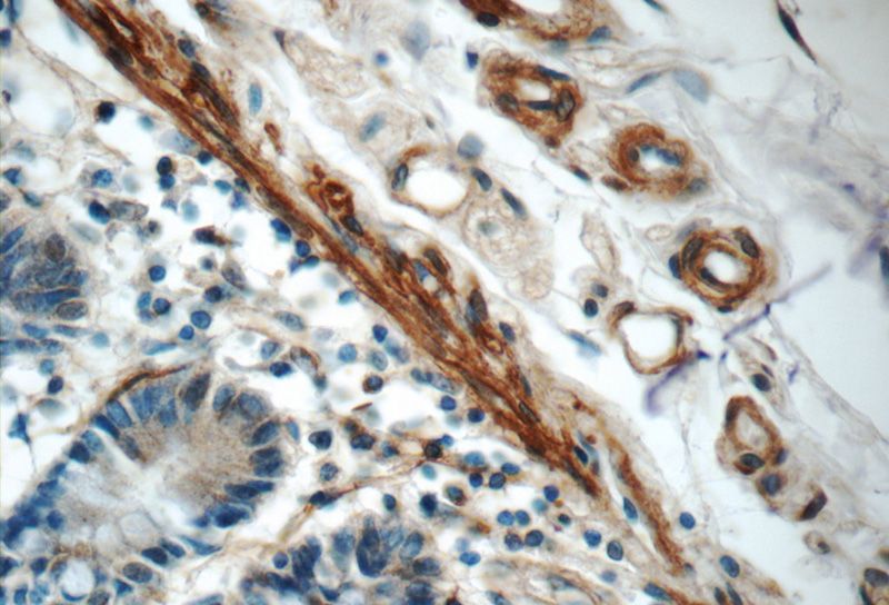 Immunohistochemistry of paraffin-embedded human small intestine tissue slide using Catalog No:112309(LPP Antibody) at dilution of 1:50 (under 40x lens)