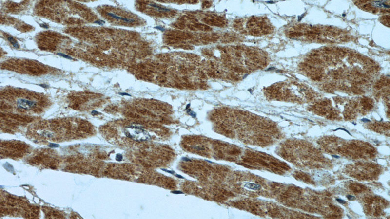 Immunohistochemical of paraffin-embedded human heart using Catalog No:117085(B3GALNT1 antibody) at dilution of 1:50 (under 40x lens)