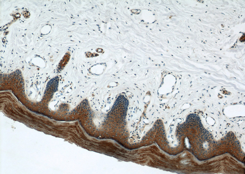 Immunohistochemical of paraffin-embedded human skin using Catalog No:109804(KRT1-specific antibody) at dilution of 1:100 (under 10x lens)