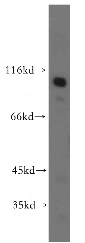mouse kidney tissue were subjected to SDS PAGE followed by western blot with Catalog No:112693(MME,CD10 antibody) at dilution of 1:500