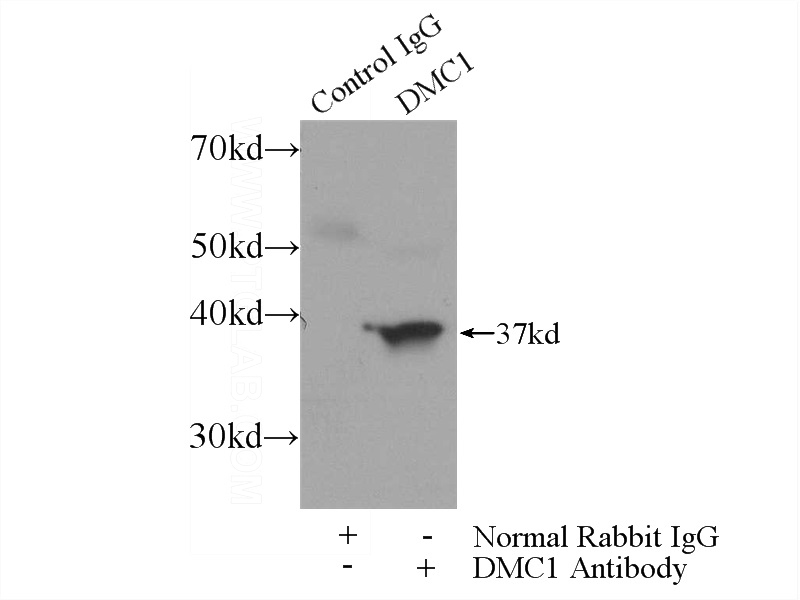 IP Result of anti-DMC1 (IP:Catalog No:110002, 3ug; Detection:Catalog No:110002 1:600) with mouse testis tissue lysate 4800ug.