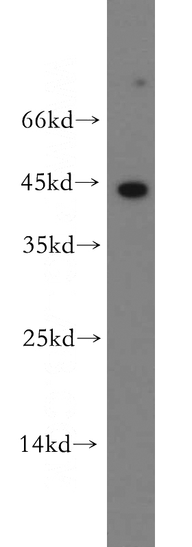 HEK-293 cells were subjected to SDS PAGE followed by western blot with Catalog No:109146(CD8B antibody) at dilution of 1:300