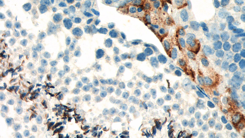 Immunohistochemistry of paraffin-embedded mouse testis tissue slide using Catalog No:115367(SLC35A1 Antibody) at dilution of 1:400 (under 40x lens). heat mediated antigen retrieved with Tris-EDTA buffer(pH9).