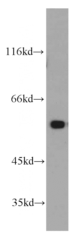 mouse skeletal muscle tissue were subjected to SDS PAGE followed by western blot with Catalog No:113860(PK-M1-specific antibody) at dilution of 1:1500