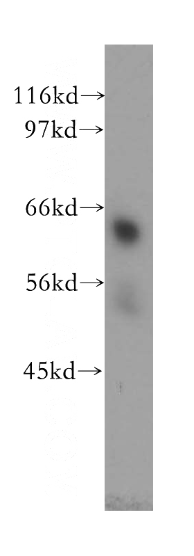 HeLa cells were subjected to SDS PAGE followed by western blot with Catalog No:116492(TULP2 antibody) at dilution of 1:300