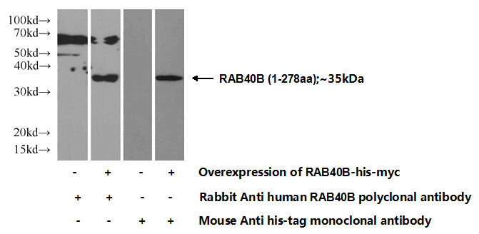 Transfected HEK-293 cells were subjected to SDS PAGE followed by western blot with Catalog No:114449(RAB40B Antibody) at dilution of 1:1000