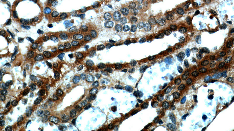 Immunohistochemical of paraffin-embedded human kidney using Catalog No:113358(NUDT19 antibody) at dilution of 1:50 (under 40x lens)