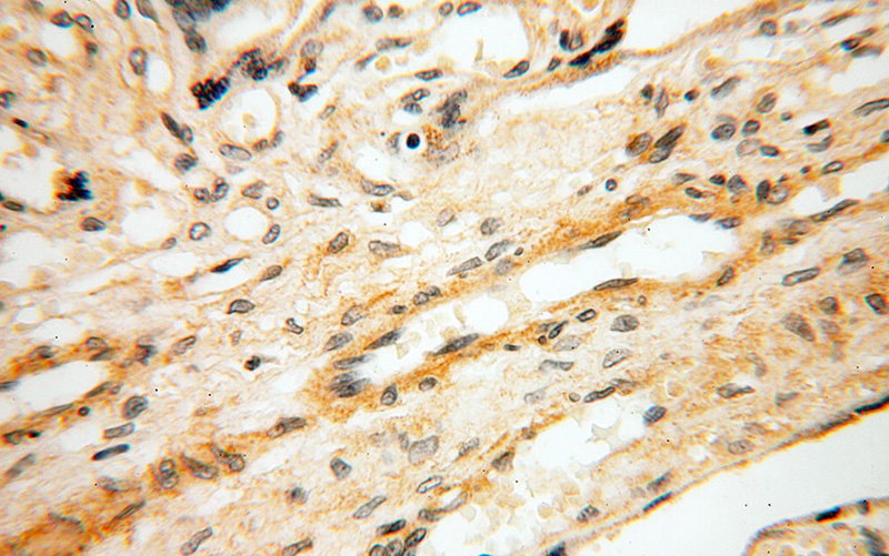 Immunohistochemical of paraffin-embedded human placenta using Catalog No:115599(SRPX2 antibody) at dilution of 1:100 (under 40x lens)