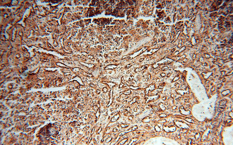 Immunohistochemical of paraffin-embedded human spleen using Catalog No:111415(HLA class I (HLA-B) antibody) at dilution of 1:100 (under 10x lens)