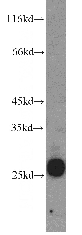 human testis tissue were subjected to SDS PAGE followed by western blot with Catalog No:109563(CRISP2 antibody) at dilution of 1:800