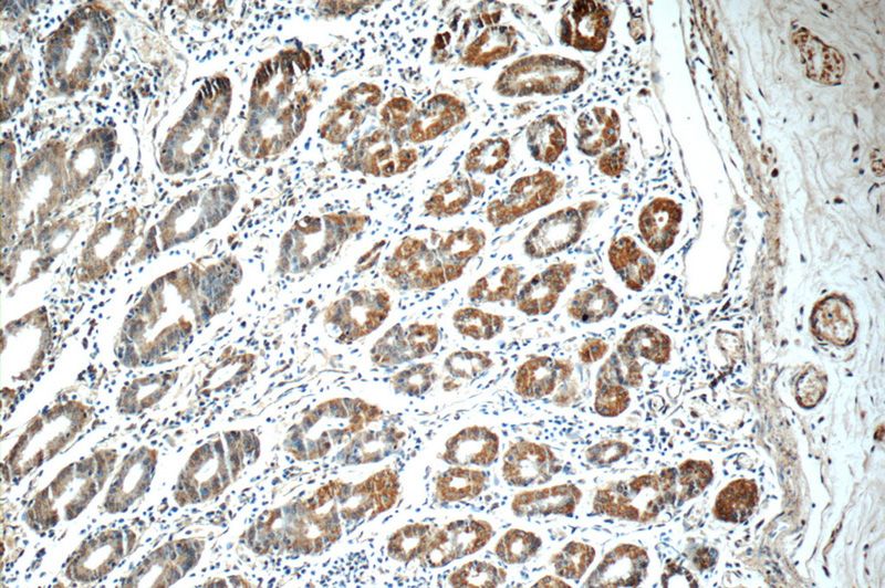 Immunohistochemistry of paraffin-embedded human stomach tissue slide using Catalog No:107759(ADA Antibody) at dilution of 1:50 (under 10x lens)