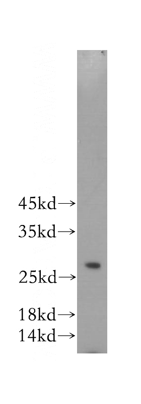 HL-60 cells were subjected to SDS PAGE followed by western blot with Catalog No:114425(RAB27A antibody) at dilution of 1:1000
