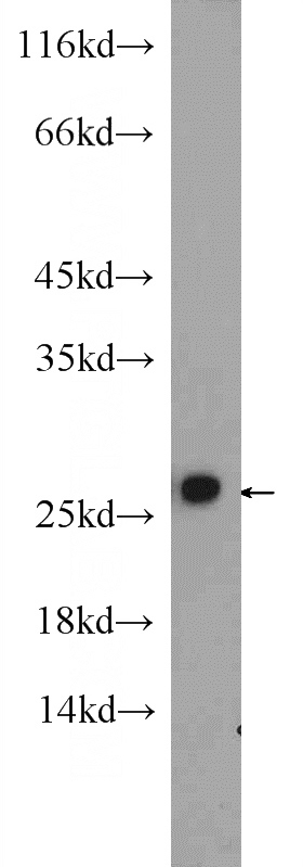 NIH/3T3 cells were subjected to SDS PAGE followed by western blot with Catalog No:114373(PSMA2 Antibody) at dilution of 1:600