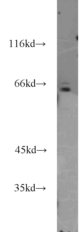 HeLa cells were subjected to SDS PAGE followed by western blot with Catalog No:111662(IL15RA antibody) at dilution of 1:500