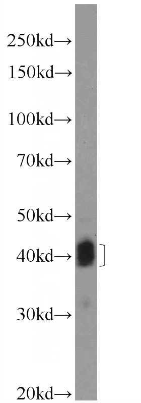 Raji cells were subjected to SDS PAGE followed by western blot with Catalog No:109010(FCER2,CD23 Antibody) at dilution of 1:600