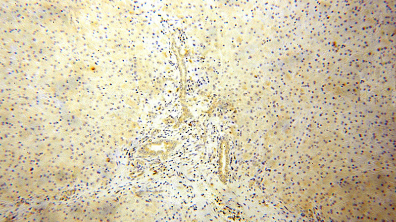 Immunohistochemical of paraffin-embedded human liver using Catalog No:114879(RPL23A antibody) at dilution of 1:100 (under 10x lens)