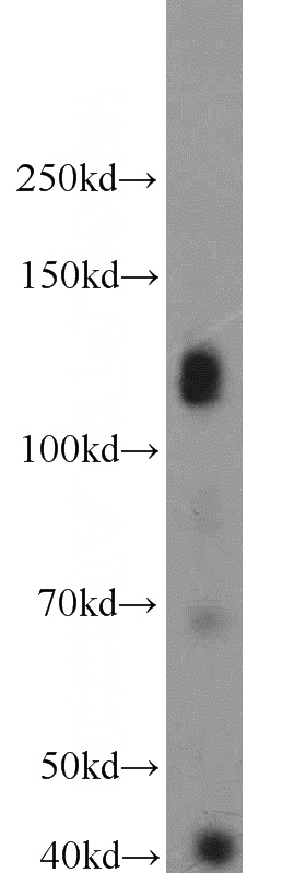 HeLa cells were subjected to SDS PAGE followed by western blot with Catalog No:111984(KIAA0528 antibody) at dilution of 1:1000