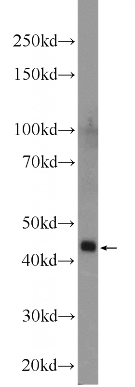 mouse kidney tissue were subjected to SDS PAGE followed by western blot with Catalog No:116938(ZDHHC13 Antibody) at dilution of 1:1000