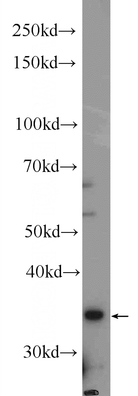 SH-SY5Y cells were subjected to SDS PAGE followed by western blot with Catalog No:109879(DBP Antibody) at dilution of 1:300